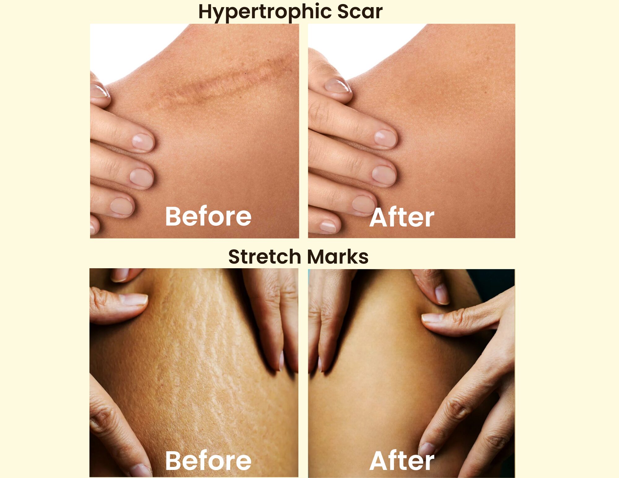 ‘No Scar’: Your Ultimate Solution for Scar Management